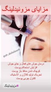 زیبایی دالیا خدمات لیزر و فیلر لب و فیشال در پیروزی 5
