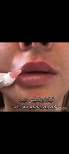 زیبایی سارا خاتون بوتاکس مزوتراپی مو و صورت در قنات کوثر 3