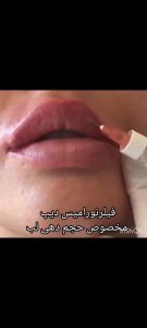 زیبایی سارا خاتون بوتاکس مزوتراپی مو و صورت در قنات کوثر 4