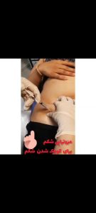 زیبایی سارا خاتون بوتاکس مزوتراپی مو و صورت در قنات کوثر 5