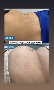 ‏زیبایی ‏الینست ‏‏فیلر ‏‏باسن ‏‏جوانسازی ‏‏هایفوتراپی ‏‏در ‏‏تهران ‏‏پاسداران 4