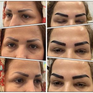 زیبایی ایران زمین کاشت مو تخصصی آقایان کاشت ابرو بانوان در الهیه 7