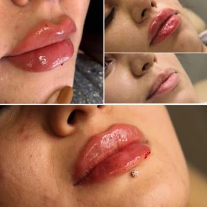 ‏زیبایی ‏نیک ‏خدمات ‏لیزر ‏موهای ‏زائد ‏و ‏بلفاروپلاستی ‏و کاشت ‏تخصصی ‏ابرو ‏در ‏کرج ‏گلشهر 12