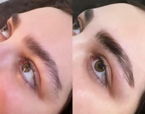 ‏زیبایی ‏نیک ‏خدمات ‏لیزر ‏موهای ‏زائد ‏و ‏بلفاروپلاستی ‏و کاشت ‏تخصصی ‏ابرو ‏در ‏کرج ‏گلشهر 2