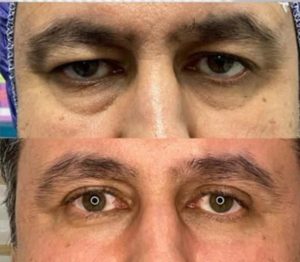 ‏زیبایی ‏نیک ‏خدمات ‏لیزر ‏موهای ‏زائد ‏و ‏بلفاروپلاستی ‏و کاشت ‏تخصصی ‏ابرو ‏در ‏کرج ‏گلشهر 5