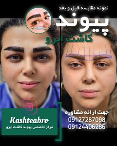 ‏زیبایی ‏پوست ‏و ‏مو ‏کاشت ‏ابرو ‏کاشت ‏مو ‏بلفاروپلاستی ‏لیپ ‏غبغب ‏بو 10