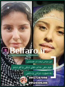 ‏زیبایی ‏پوست ‏و ‏مو ‏کاشت ‏ابرو ‏کاشت ‏مو ‏بلفاروپلاستی ‏لیپ ‏غبغب ‏بو 12