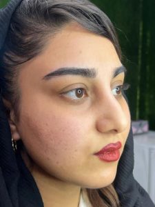 ‏‏زیبایی ‏‏مانلی ‏‏دکتر ‏‏دهقان ‏‏مزونیدلینگ ‏‏هایفوتراپی ‏‏کرایو ‏‏تراپی ‏‏زگیل ‏‏تناسلی ‏‏ 5