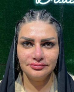 ‏‏زیبایی ‏‏مانلی ‏‏دکتر ‏‏دهقان ‏‏مزونیدلینگ ‏‏هایفوتراپی ‏‏کرایو ‏‏تراپی ‏‏زگیل ‏‏تناسلی ‏‏ 6