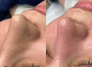 خدمات فیشال کروبکسی تراپی آنزیم تراپی مزونیدلینگ در گوهردشت کرج 9