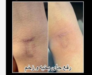 قدیانی فر خدمات تزریق بوتاکس مزوژل مزوتراپی در تهران زعفرانیه 25