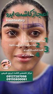 ‏زیبایی ‏کاشت ‏ابرو ‏بلفاروپلاستی ‏لیپو ‏غبغب ‏بوکال ‏فت ‏سانترال ‏لب ‏لیفت ‏شقیقه ‏در ‏تهران ‏یوسف ‏آباد