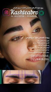 ‏زیبایی ‏کاشت ‏ابرو ‏بلفاروپلاستی ‏لیپو ‏غبغب ‏بوکال ‏فت ‏سانترال ‏لب ‏لیفت ‏شقیقه ‏در ‏تهران ‏یوسف ‏آباد 3