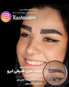 ‏زیبایی ‏کاشت ‏ابرو ‏بلفاروپلاستی ‏لیپو ‏غبغب ‏بوکال ‏فت ‏سانترال ‏لب ‏لیفت ‏شقیقه ‏در ‏تهران ‏یوسف ‏آباد 3