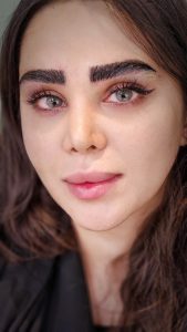 ‏زیبایی ‏کاشت ‏ابرو ‏بلفاروپلاستی ‏لیپو ‏غبغب ‏بوکال ‏فت ‏سانترال ‏لب ‏لیفت ‏شقیقه ‏در ‏تهران ‏یوسف ‏آباد 4