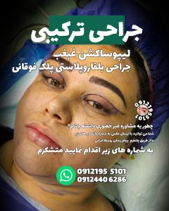 ‏زیبایی ‏کاشت ‏ابرو ‏بلفاروپلاستی ‏لیپو ‏غبغب ‏بوکال ‏فت ‏سانترال ‏لب ‏لیفت ‏شقیقه ‏در ‏تهران ‏یوسف ‏آباد 4