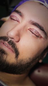 ‏زیبایی ‏کاشت ‏ابرو ‏بلفاروپلاستی ‏لیپو ‏غبغب ‏بوکال ‏فت ‏سانترال ‏لب ‏لیفت ‏شقیقه ‏در ‏تهران ‏یوسف ‏آباد 6