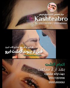 ‏زیبایی ‏کاشت ‏ابرو ‏بلفاروپلاستی ‏لیپو ‏غبغب ‏بوکال ‏فت ‏سانترال ‏لب ‏لیفت ‏شقیقه ‏در ‏تهران ‏یوسف ‏آباد 9