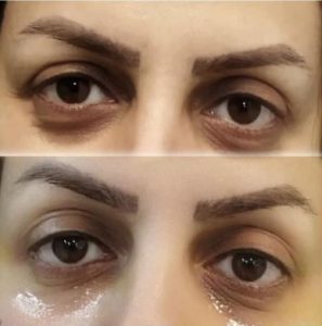 ‏فهیمه ‏درفشی ‏خدمات ‏مزوژل ‏کاشت ‏مو ‏بوتاکس ‏در ‏تهران شریعتی 2 1