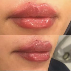 ‏فهیمه ‏درفشی ‏خدمات ‏مزوژل ‏کاشت ‏مو ‏بوتاکس ‏در ‏تهران شریعتی 3 1