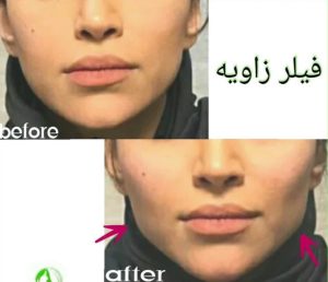 ‏فهیمه ‏درفشی ‏خدمات ‏مزوژل ‏کاشت ‏مو ‏بوتاکس ‏در ‏تهران شریعتی 7 1